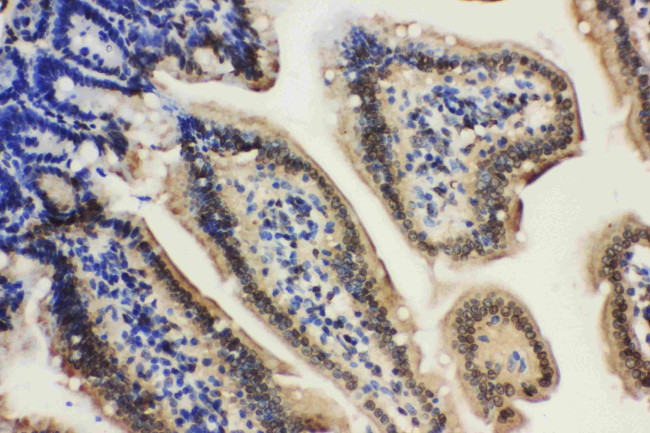 Lamin A/C Antibody in Immunohistochemistry (Paraffin) (IHC (P))