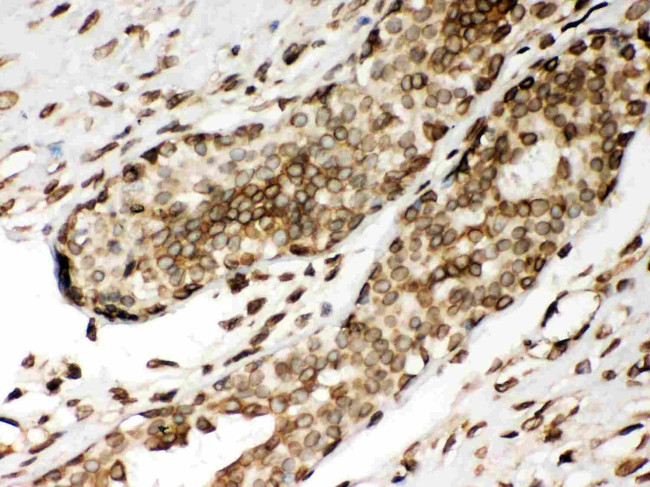 Lamin A/C Antibody in Immunohistochemistry (Paraffin) (IHC (P))