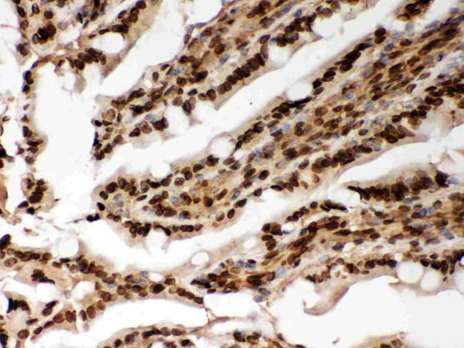 Lamin A/C Antibody in Immunohistochemistry (Paraffin) (IHC (P))