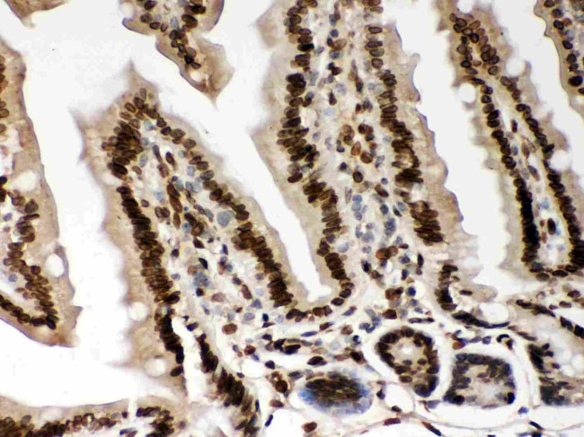 Lamin A/C Antibody in Immunohistochemistry (Paraffin) (IHC (P))