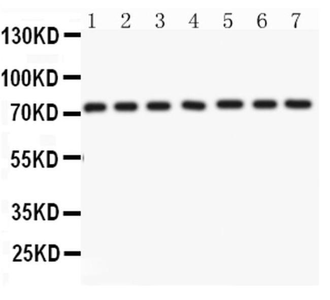 Lamin A/C Antibody in Western Blot (WB)