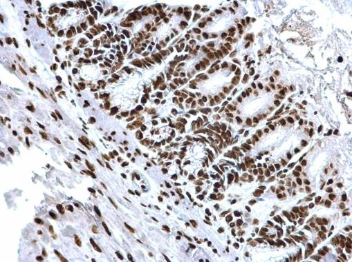 H3K18ac Antibody in Immunohistochemistry (Paraffin) (IHC (P))