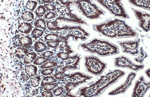 H3K18ac Antibody in Immunohistochemistry (Paraffin) (IHC (P))