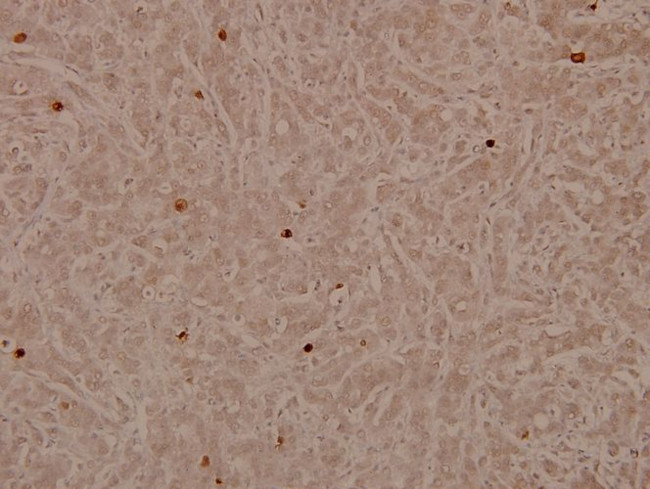 Lamin A/C Antibody in Immunohistochemistry (Paraffin) (IHC (P))