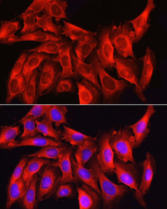 Caspase 1 Antibody in Immunocytochemistry (ICC/IF)