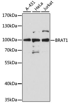 BAAT1 Antibody in Western Blot (WB)