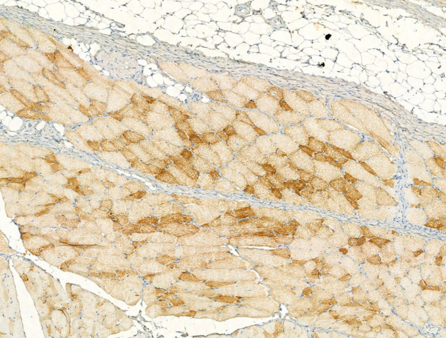 Caspase 1 p20 (Cleaved Asp296) Antibody in Immunohistochemistry (Paraffin) (IHC (P))