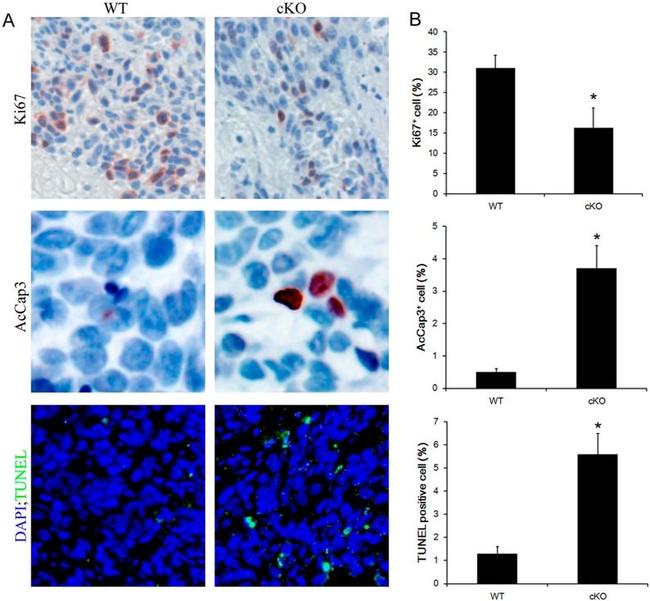 Ki-67 Antibody in Immunohistochemistry (Paraffin) (IHC (P))