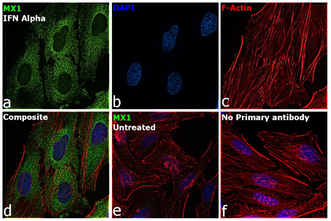 MX1 Antibody in Immunocytochemistry (ICC/IF)