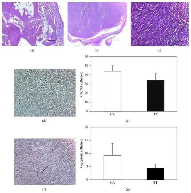 PCNA Antibody in Immunohistochemistry (Paraffin) (IHC (P))