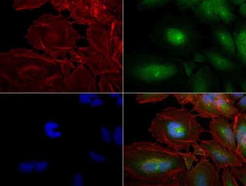 PCNA Antibody in Immunocytochemistry (ICC/IF)