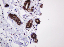 PCNA Antibody in Immunohistochemistry (Paraffin) (IHC (P))