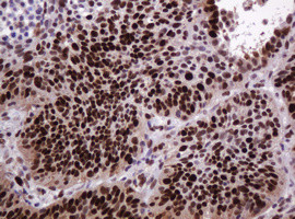 PCNA Antibody in Immunohistochemistry (Paraffin) (IHC (P))