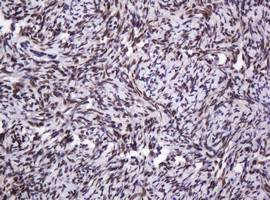 PCNA Antibody in Immunohistochemistry (Paraffin) (IHC (P))