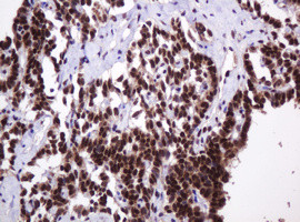 PCNA Antibody in Immunohistochemistry (Paraffin) (IHC (P))