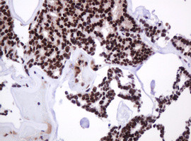 PCNA Antibody in Immunohistochemistry (Paraffin) (IHC (P))