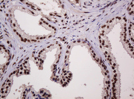 PCNA Antibody in Immunohistochemistry (Paraffin) (IHC (P))