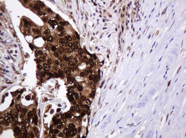 PCNA Antibody in Immunohistochemistry (Paraffin) (IHC (P))