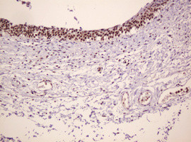 PCNA Antibody in Immunohistochemistry (Paraffin) (IHC (P))