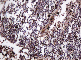 PCNA Antibody in Immunohistochemistry (Paraffin) (IHC (P))