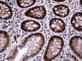 PCNA Antibody in Immunohistochemistry (Paraffin) (IHC (P))