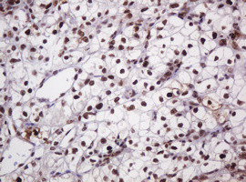 PCNA Antibody in Immunohistochemistry (Paraffin) (IHC (P))