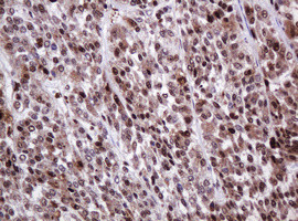 PCNA Antibody in Immunohistochemistry (Paraffin) (IHC (P))