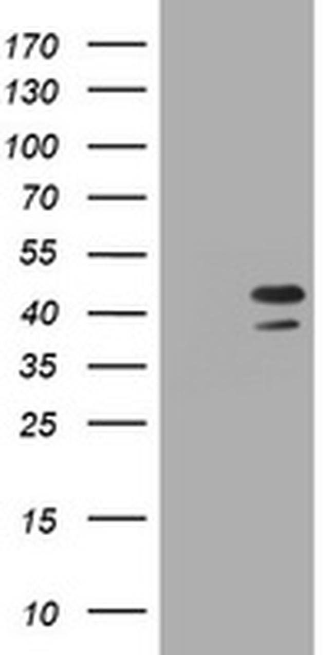 PCNA Antibody in Western Blot (WB)