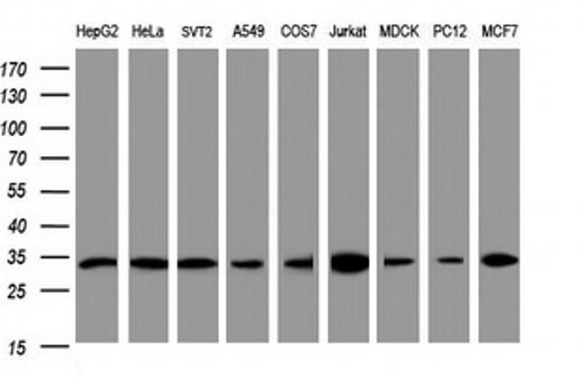 PCNA Antibody in Western Blot (WB)