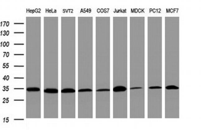 PCNA Antibody in Western Blot (WB)