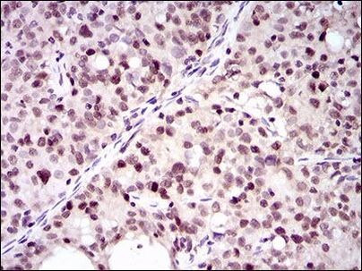 PCNA Antibody in Immunohistochemistry (Paraffin) (IHC (P))