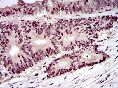 PCNA Antibody in Immunohistochemistry (Paraffin) (IHC (P))