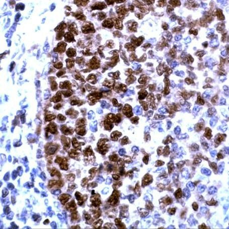 PCNA Antibody in Immunohistochemistry (Paraffin) (IHC (P))