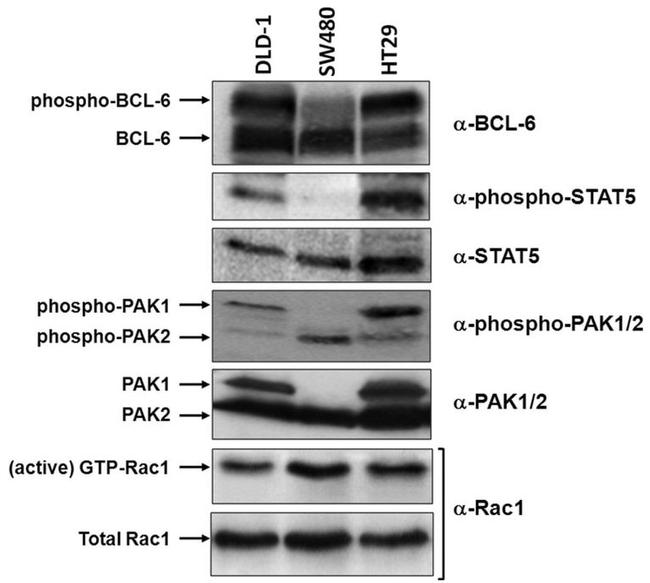 STAT5 alpha Antibody in Western Blot (WB)