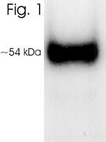 VDR Antibody in Western Blot (WB)