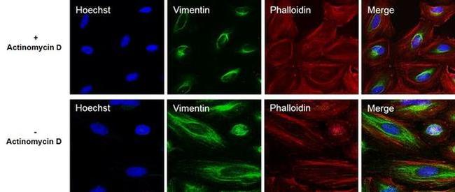 Vimentin Antibody