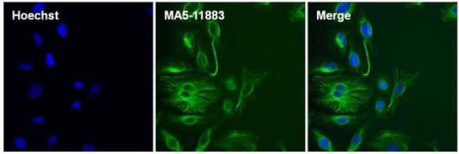 Vimentin Antibody in Immunocytochemistry (ICC/IF)