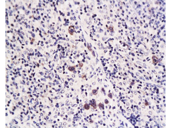 Caspase-1 P10 Antibody in Immunohistochemistry (Paraffin) (IHC (P))