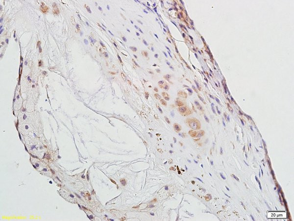 PPAR Gamma Antibody in Immunohistochemistry (Paraffin) (IHC (P))