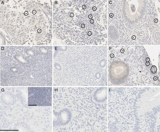 FOXP3 Antibody in Immunohistochemistry (IHC)