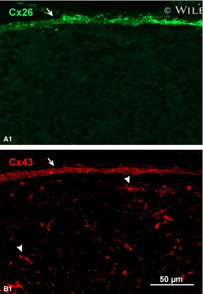 Connexin 26 Antibody in Immunohistochemistry (IHC)