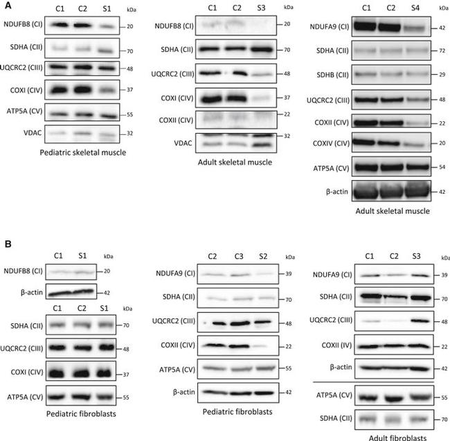 SDHA Antibody in Western Blot (WB)