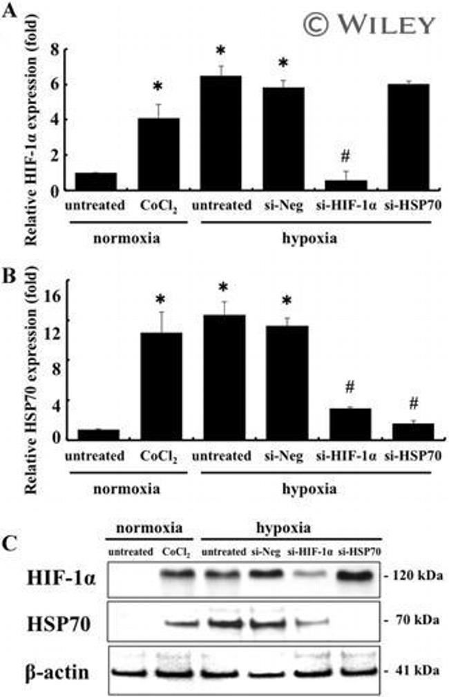 HIF1A Antibody in Western Blot (WB)