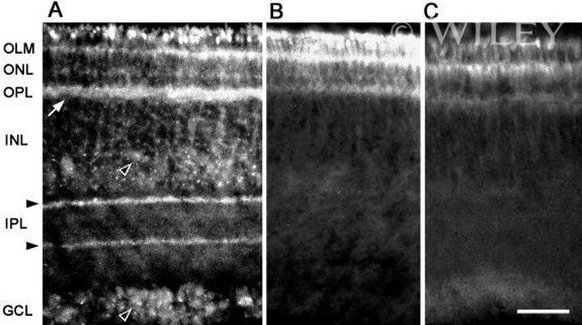 Connexin 26 Antibody in Immunohistochemistry (IHC)