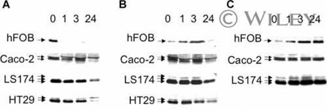 VDR Antibody in Western Blot (WB)