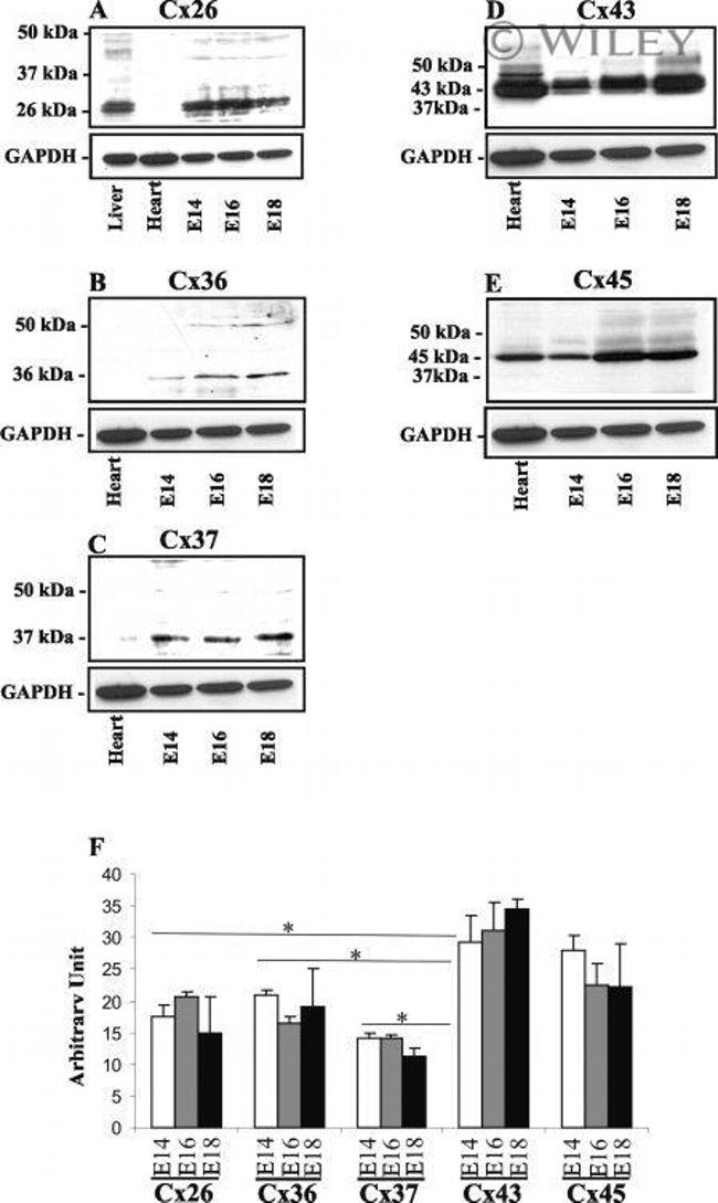 Connexin 26 Antibody in Western Blot (WB)