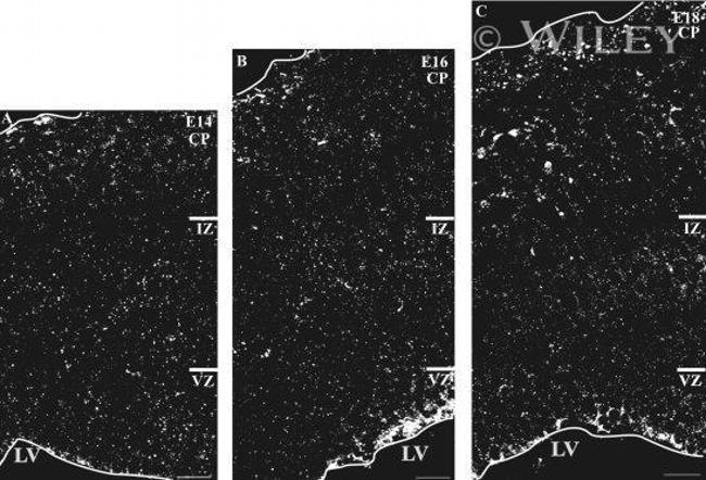 Connexin 26 Antibody in Immunohistochemistry (IHC)