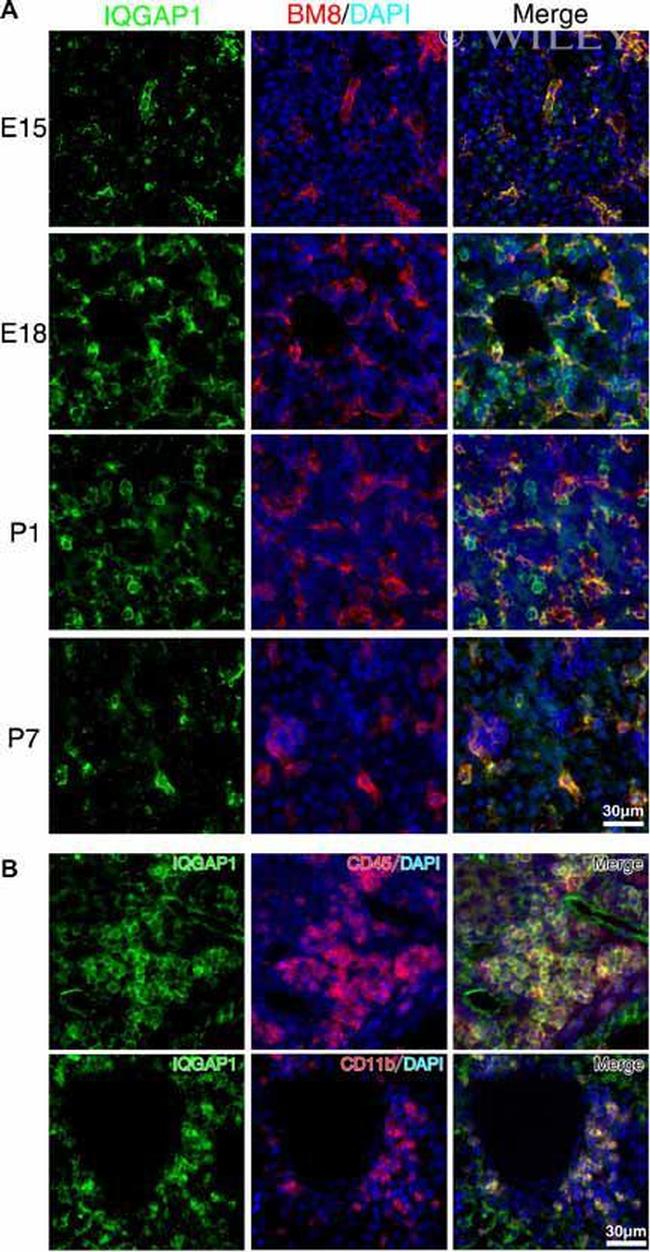 CD11b Antibody in Immunohistochemistry (IHC)