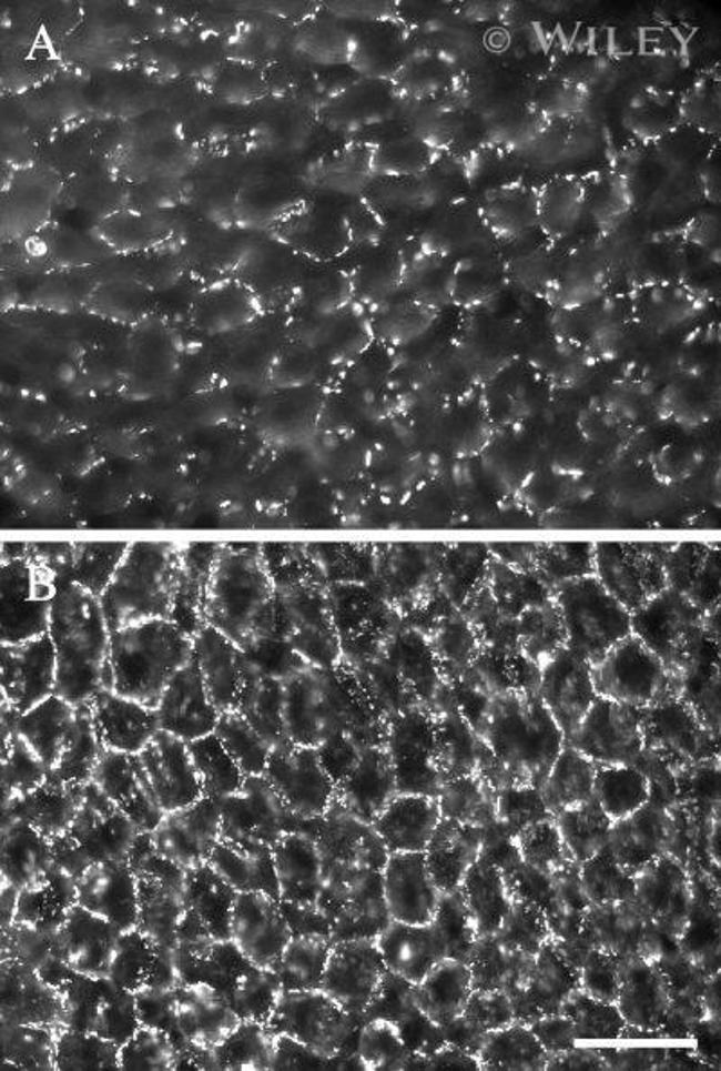 Connexin 26 Antibody in Immunohistochemistry (IHC)