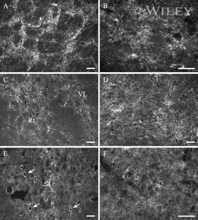 Connexin 26 Antibody in Immunohistochemistry (IHC)